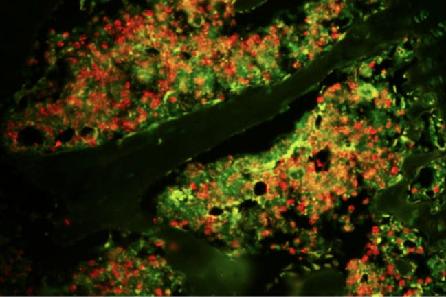 Image showing an increase of myeloid-derived suppressor cells the bone marrow of mice that have been treated with antibiotics.
