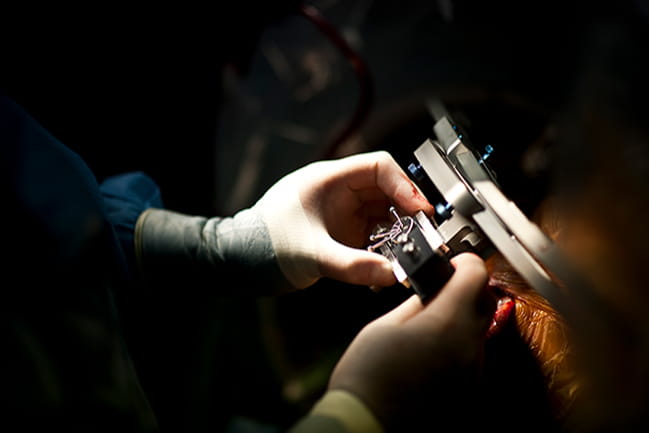 Photo of brain surgery